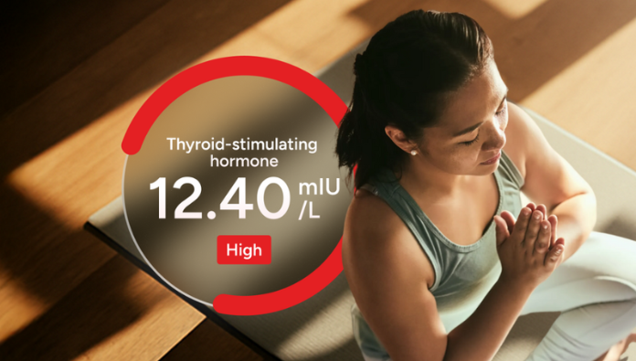 Save up to 20% on thyroid tests